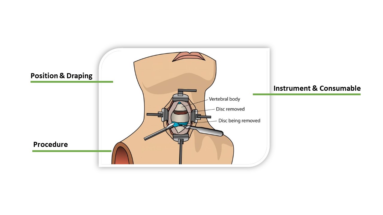 Cervical ASF