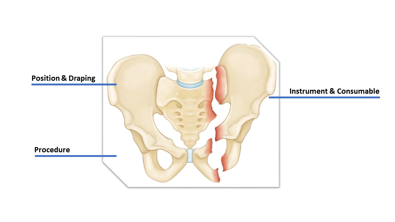 Pelvis fracture